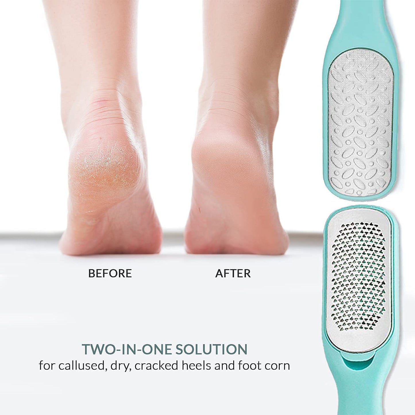 Relax Tony Callus Remover for Feet | Double-Sided Foot Scrub